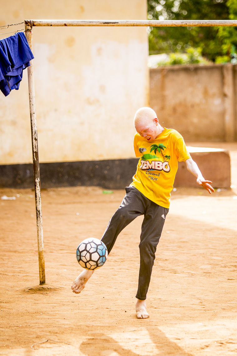A young boy with Albinism kicks a ball in a dirt courtyard in East Africa