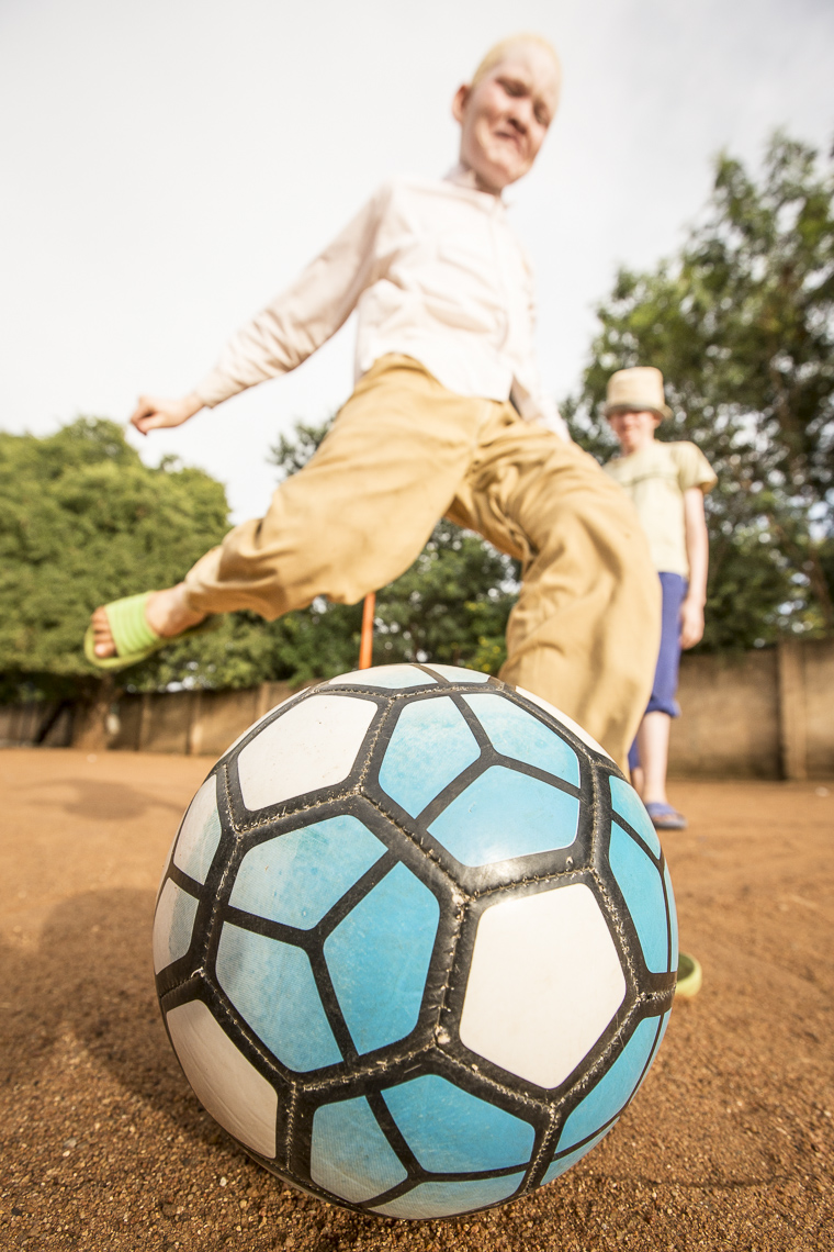 Closeup of a soccer ball being kicked by an albino boy in a schoolyard in East Africa