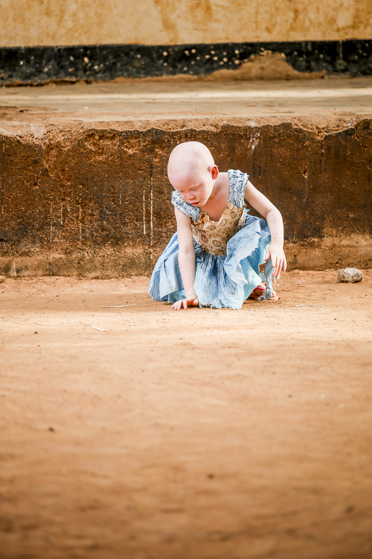 A small albino girl plays inside a facilty for childern in East Africa 