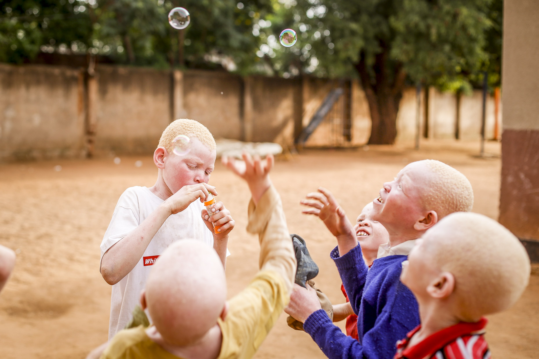 A group of albino boys delight in chasing bubbles in the coutyard of an East African orphanage