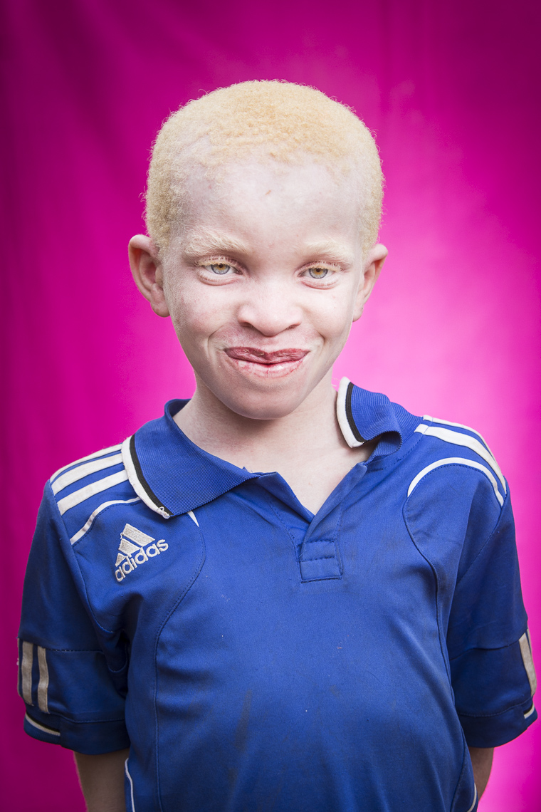 A proud young Albino boy beasm for the camera during a portrait session