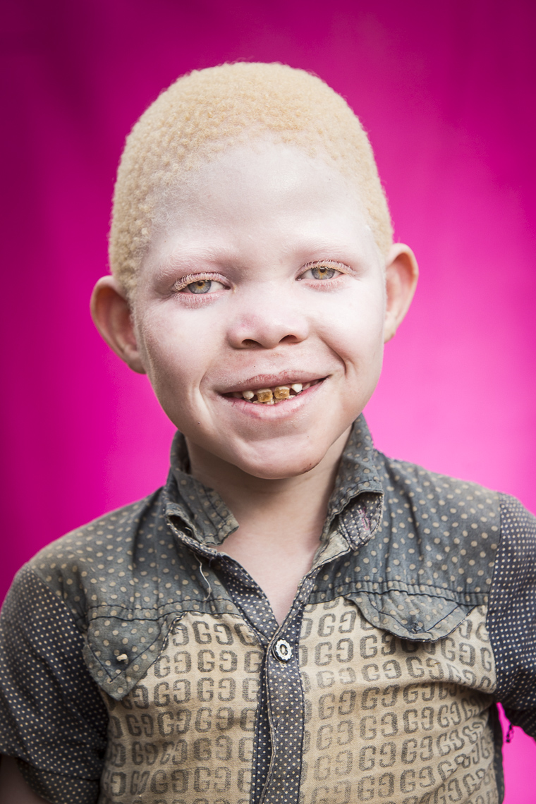 A series of portriats of albino children set on a pink background in East Africa