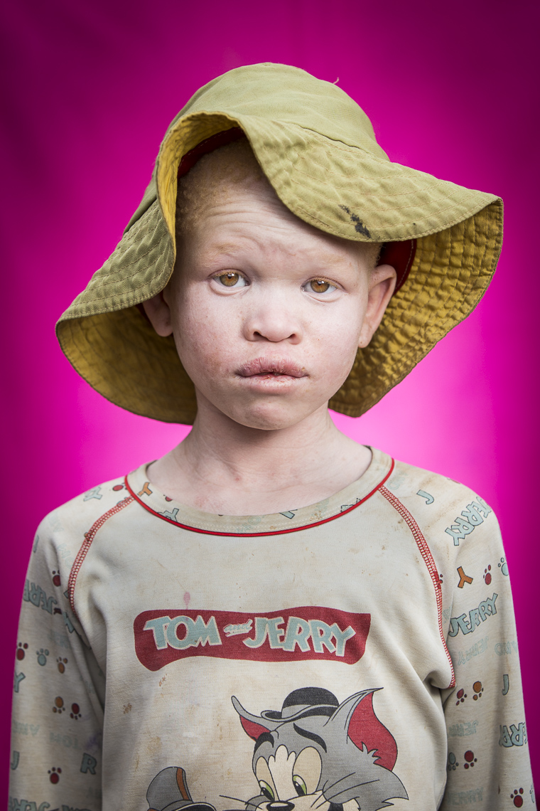 A series of portriats of children living with Albinism in East Africa