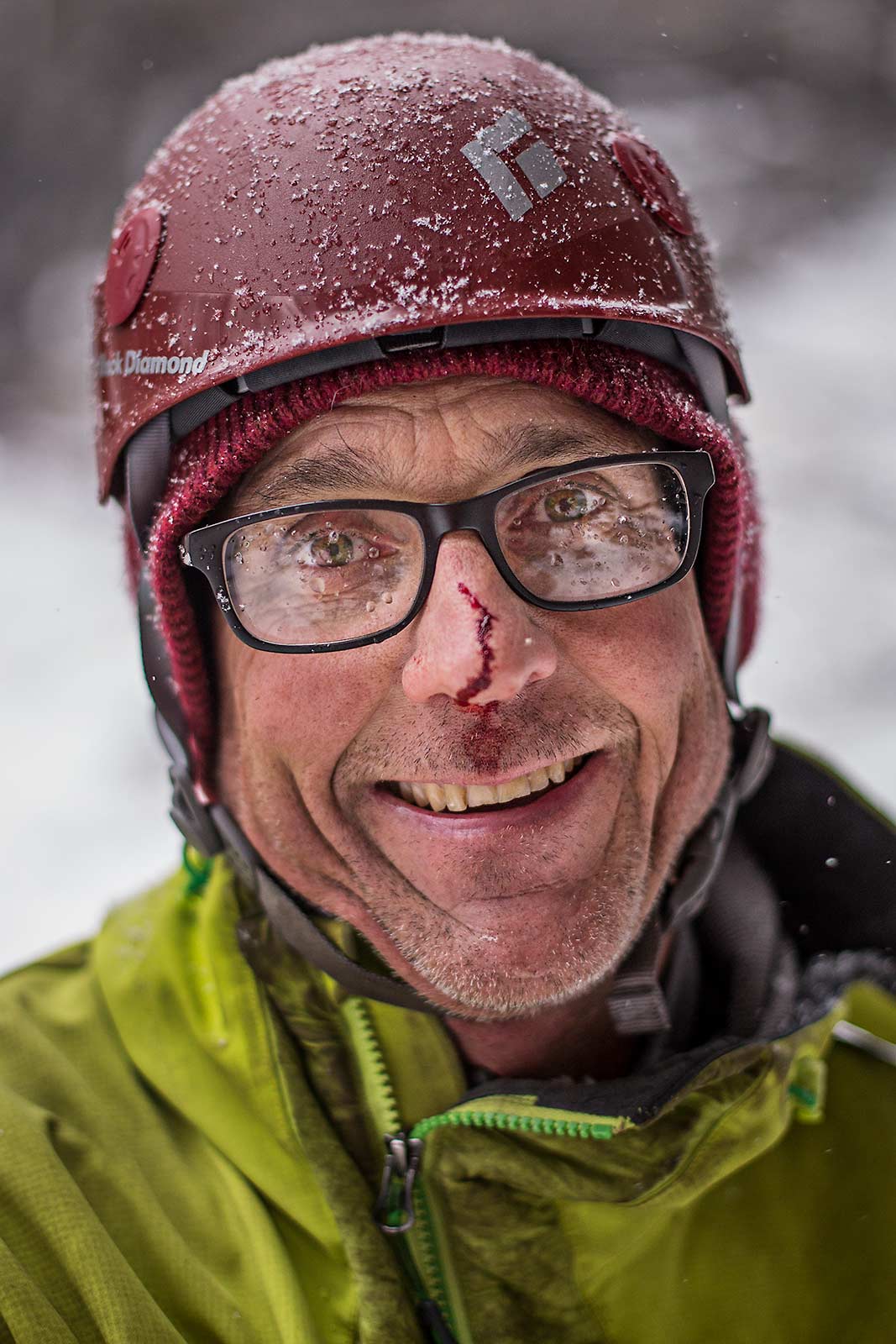A closeup portrait of an ice climber coated with fresh snow and with a bloddy nose in New York 